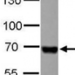 Serum Albumin