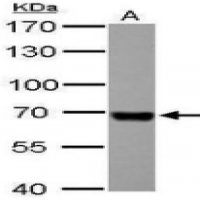 Serum Albumin